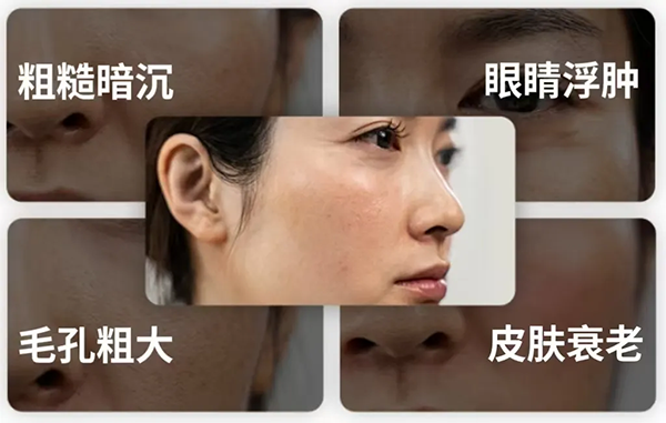 冰磯堂顏究站 | 熬夜后皮膚為何會(huì)變黃？